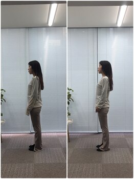 カルペード 中百舌鳥/なかもず院(Carpe D.)/施術後の変化