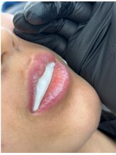 リュミエール デスポワール(Lumiere d'espoir)/ローマピンク