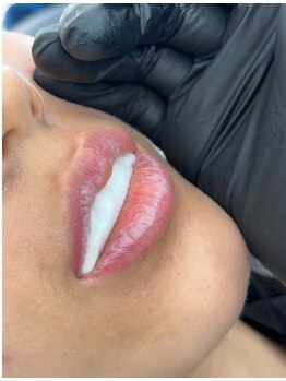 リュミエール デスポワール(Lumiere d'espoir)/ローマピンク