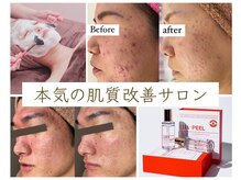 ホワイトアクア 京橋店(WHITE AQUA)/結果重視の本気の肌質改善サロン