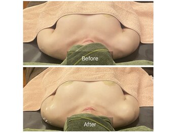 ベンザイ 新潟店(BENZAI)/くすみ、巡りが悪い、育乳