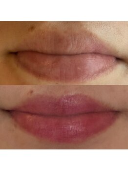 ピンクトーンプログラム 本店(PINK TONE PROGRAM)/ピンクトーン　リップ施術直後