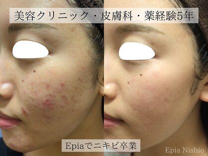 エピア 西尾店(Epia)の写真