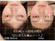 エモーション(Emotion)の写真