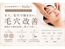 ステラ(Stella)