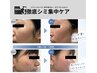 【5周年祭】新導入！徹底集中◎シミケア・フェイシャル16,500円→11,000円