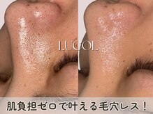 ルコル(LUCOL)