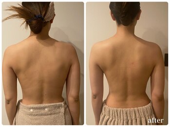 アロラヴィ(AroRavi)/ブライダルエステ