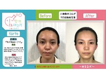 小顔整体研究所 KSラボ 天王寺店/