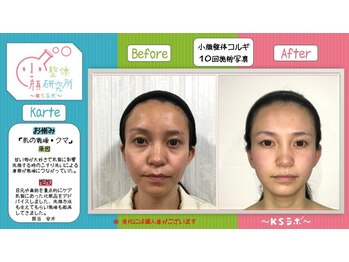 小顔整体研究所 KSラボ 天王寺店/