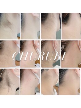 チュルリ 新町店(Chururi)/うなじ/ワックス脱毛