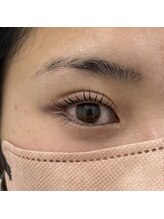 レジアント(Rediant)/