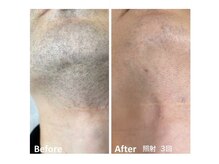 ウル(Ulu)/【濃いヒゲにも！】