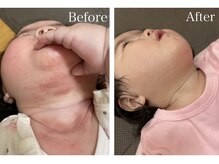 スマートポッシュ(Smart posh)/【子供】before→after