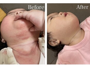 スマートポッシュ(Smart posh)/【子供】before→after