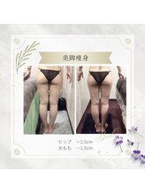 アディッシモ(addissimo)/セルマシーンで頑固な脂肪を分解