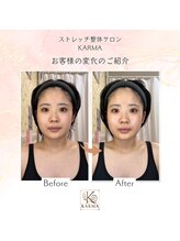 カルマ(KARMA)/MENU【小顔ストレッチ】