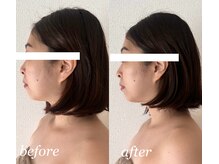 アトリエドゥアージュ(Atelier de age)/ハリ、くすみ！コウシリフト、2