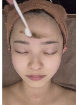 リラクゼーションサロン ラキ(laki)/ハーブピーリング/ピーリング