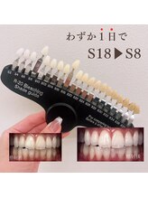 ブリエ(BRILLER)/《医》高効果ホワイトニング症例