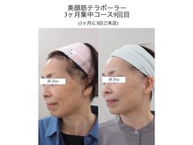 Beauty salon TCM　【小顔/たるみ/バストアップ】/肌質改善