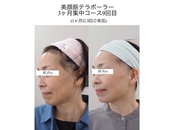 Beauty salon TCM 【小顔/たるみ/バストアップ】/肌質改善