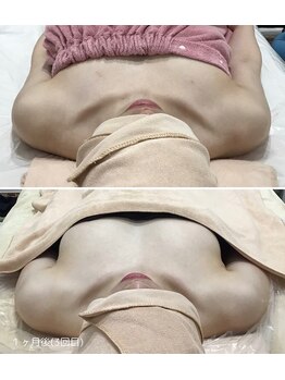 ビューティーサロン シンデレラ 心斎橋本店(Cinderella)/理想のふわふわバスト