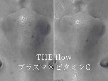 ザ フロウ(THE flow)/押し出さず分解！最新毛穴ケア