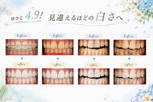 ホワイトニングショップ 府中店