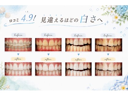 ホワイトニングショップ 府中店の写真