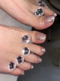 まき爪ケアしながらフットネイル