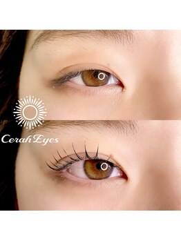 チュラアイズ(CerahEyes)/【お客様ビフォーアフター】