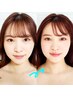 【リピートNo.1】メイクしたまま速効小顔★美容鍼＋小顔矯正 30分¥6980