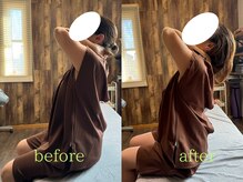 アポヨ鍼灸院(APOYO鍼灸院)/肩こり改善　before/after
