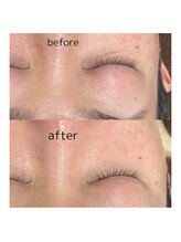 アモール 丸亀店(Amor)/眉毛/まつげパーマ/毛穴/脱毛