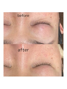 アモール 丸亀店(Amor)/眉毛/まつげパーマ/毛穴/脱毛