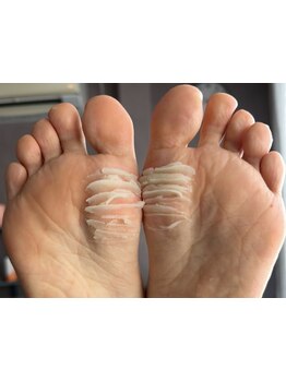 角質ケアができるサロン