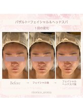 リトリコ アロマ(ritorico_aroma)/癒しのフェイシャル＆ヘッドスパ