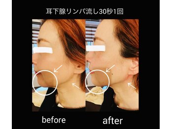 マシュマロヘッド 目黒店(Mashumaro Head)/本格顔深層筋小顔フェイシャル 