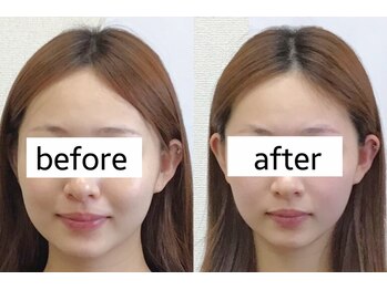 ムーンライズ(moonrise)/