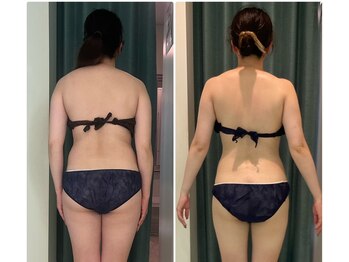 マリスレジーナ(Maris Regina)/ブライダルエステ