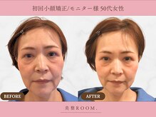 美整ルーム 横浜店(美整ROOM)の雰囲気（満足度の高い小顔矯正をご提供☆美整小顔を作り上げます！/横浜）