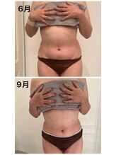 美人バスト 本厚木店/【痩身】症例☆