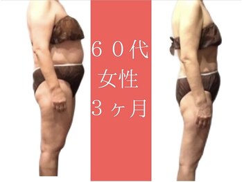 ムーン(MOON)/何歳からでも美しく！