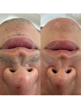 ツルんです。研究所 ウイ(Ui)の写真/実績豊富で初めてでも安心の脱毛へ。お客様に寄り添った提案とコスパ良い施術を☆