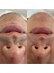 ツルんです。研究所 ウイ(Ui)の写真/実績豊富で初めてでも安心の脱毛へ。お客様に寄り添った提案とコスパ良い施術を☆