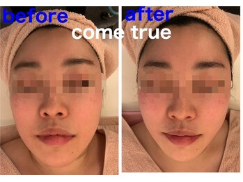 モテ肌 小顔コルギサロン カムトゥルー(come true)/小顔コルギ+ポレーション