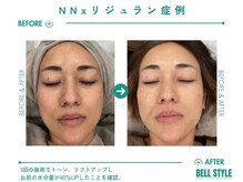 ベルスタイル(Bell style)/リジュランで美肌育成！水分量UP