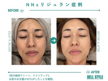 ベルスタイル(Bell style)/リジュランで美肌育成！水分量UP