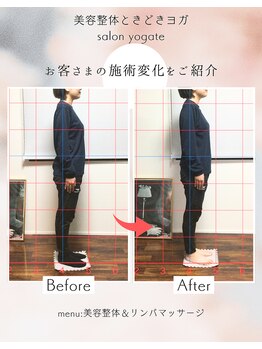ヨギート(yogate)/リンパ/骨盤矯正/ヘッドスパ小顔